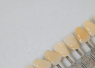 Veneers Vorher Nachher: Unglaubliche Verwandlungen Entdecken!